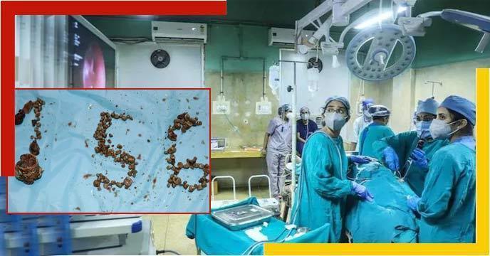156-kidney-stones