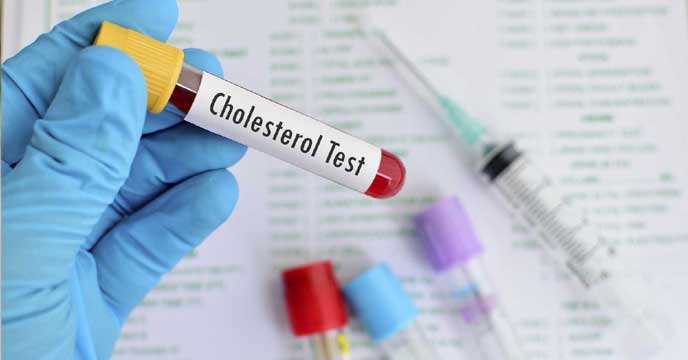 LDL cholesterol