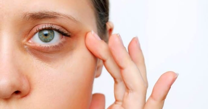 Eye Care