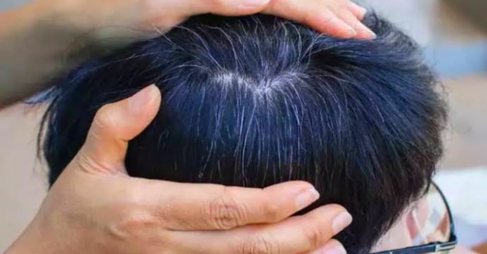 Grey Hair
