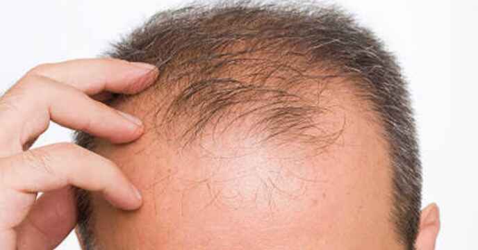 Hair Tips