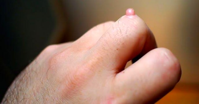 Skin Tips
