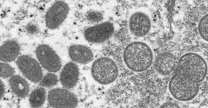 B-Virus