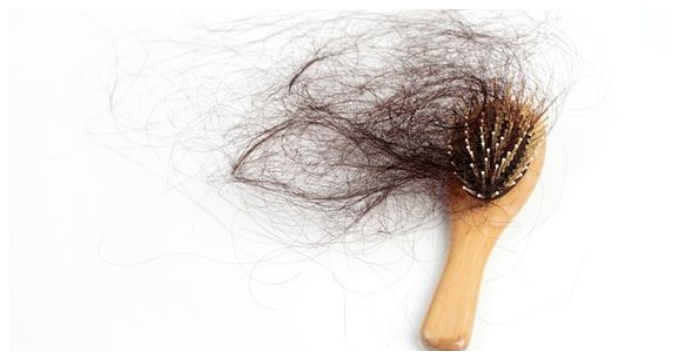 hair fall