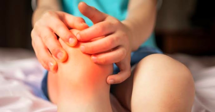 Juvenile Arthritis
