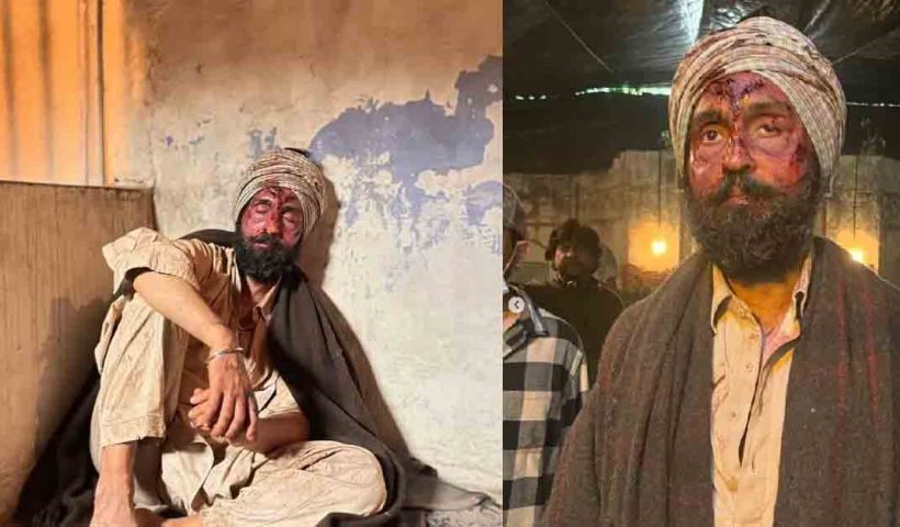 Diljit Dosanjh shared shocking photos with his face covered in blood, leaving fans curious and concerned. Discover the reason behind these viral images, related to his upcoming movie.