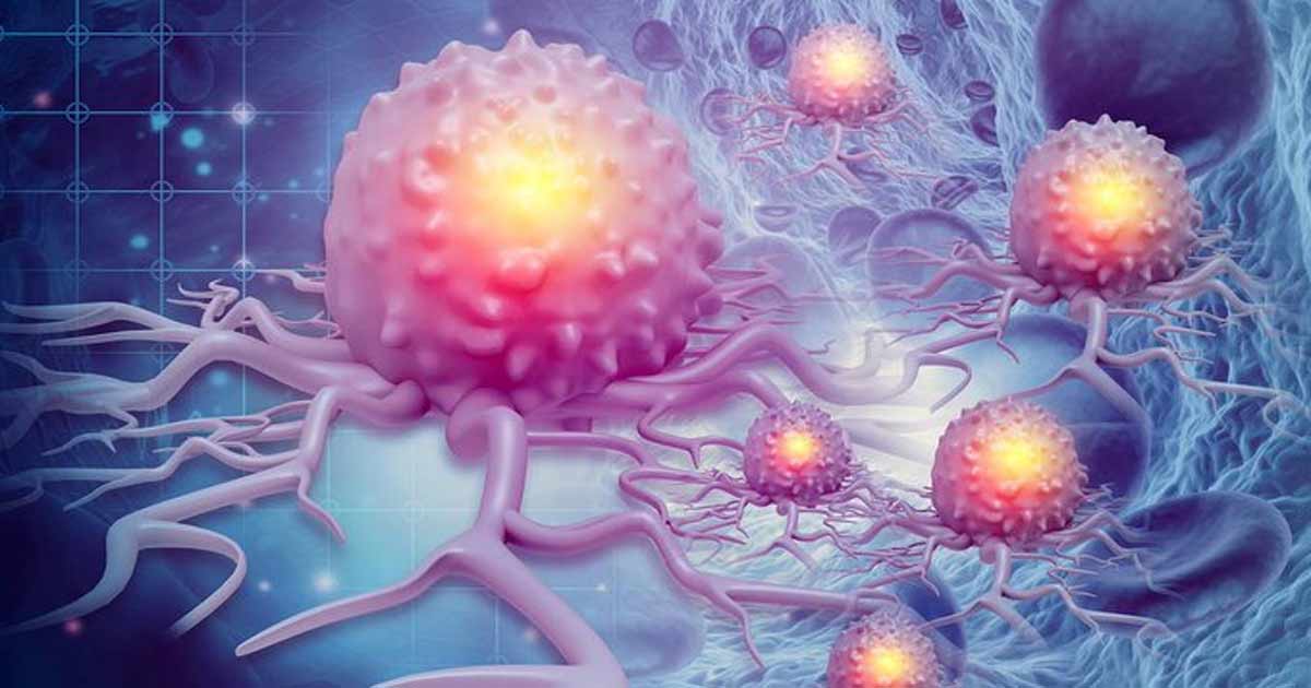 Air pollution is increasing the risk of cancer
