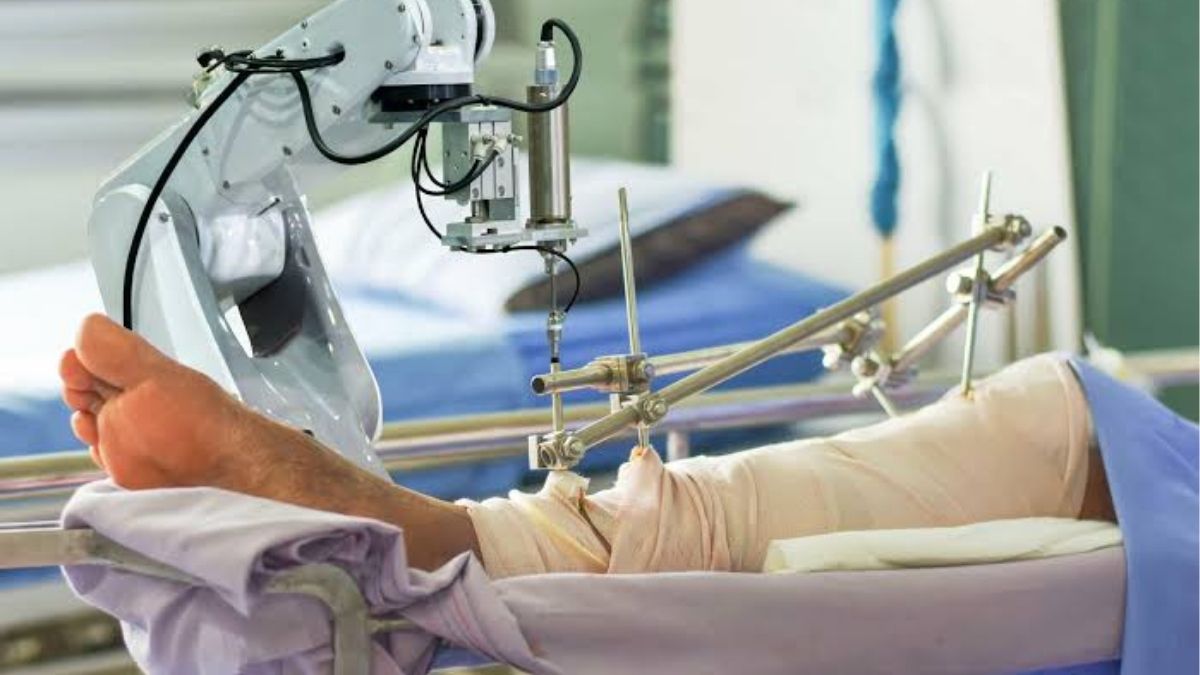 robotic-knee-replacement-safdarjung